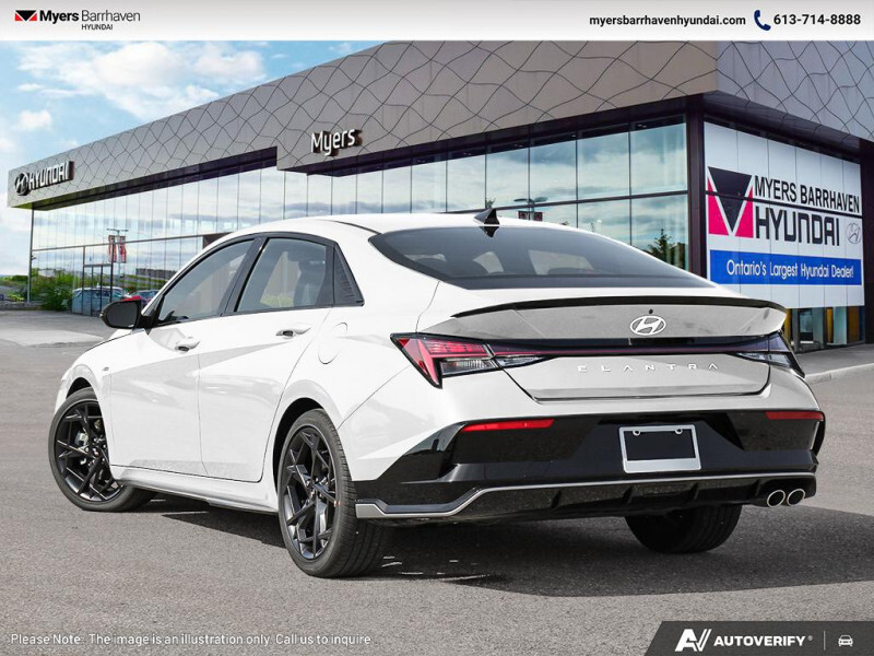 2025 Hyundai Elantra - Gallery image 3