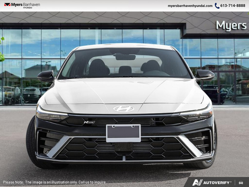 2025 Hyundai Elantra - Gallery image 1