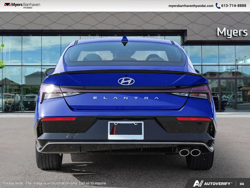 2025 Hyundai Elantra - Gallery image 4