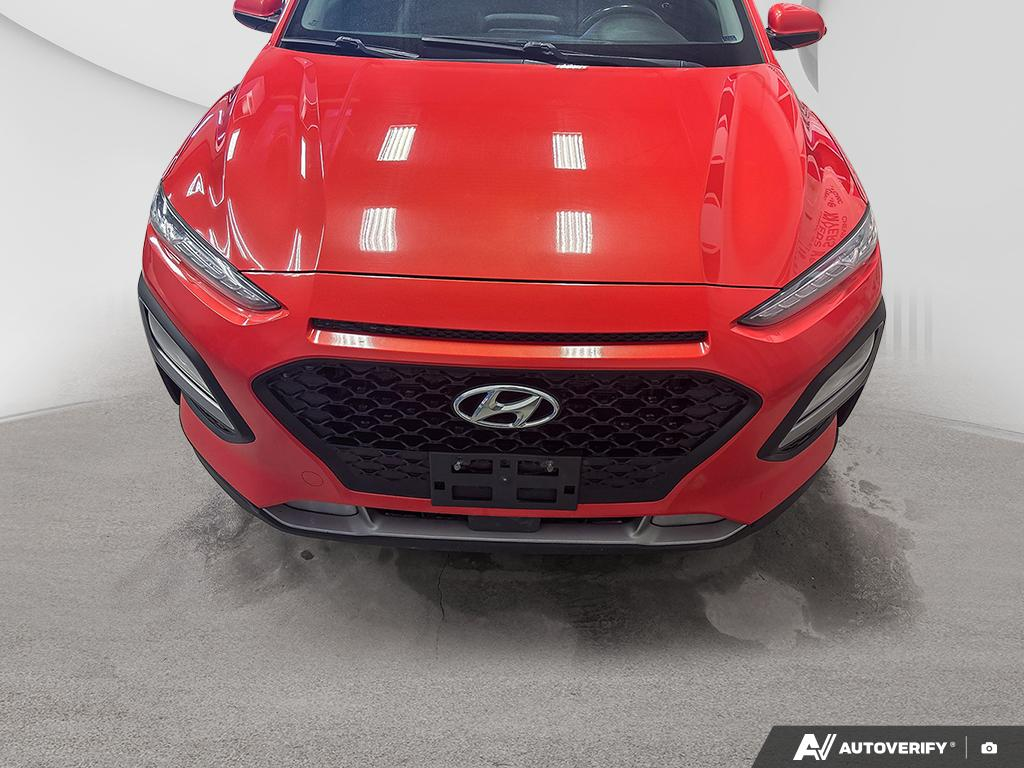 2018 Hyundai Kona - Gallery image 1