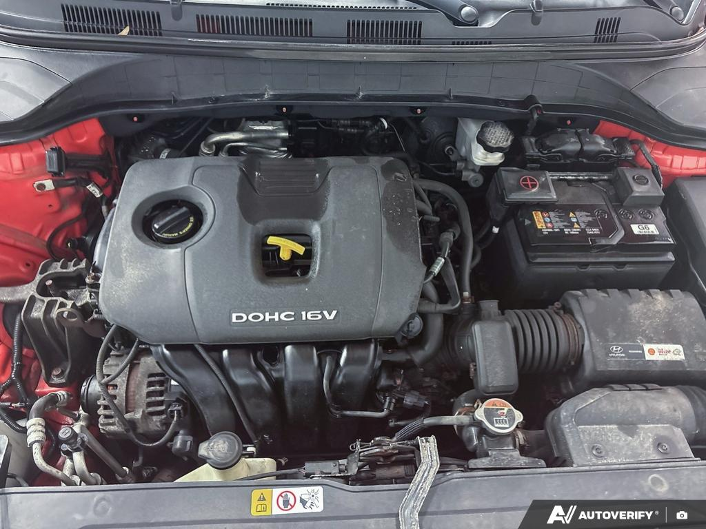 2018 Hyundai Kona - Gallery image 9