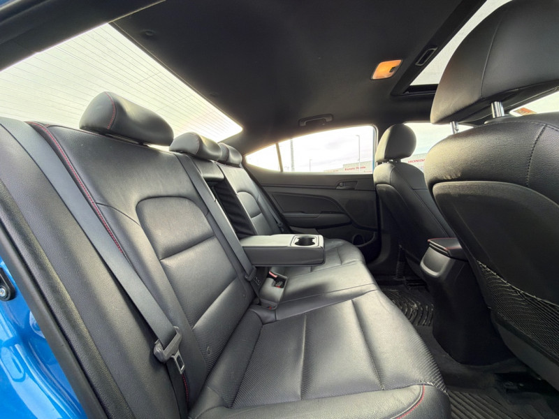2018 Hyundai Elantra Sport - Gallery image 15