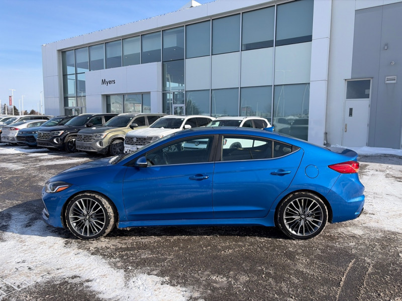 2018 Hyundai Elantra Sport - Gallery image 1