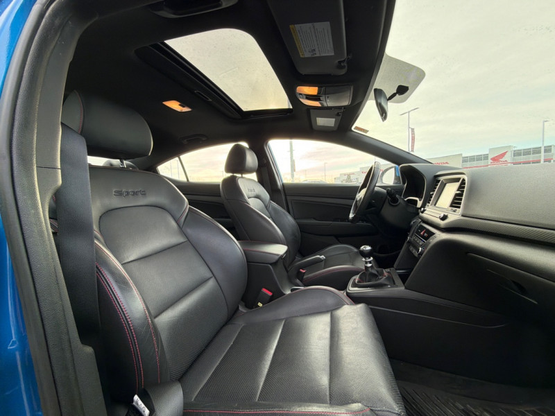 2018 Hyundai Elantra Sport - Gallery image 5